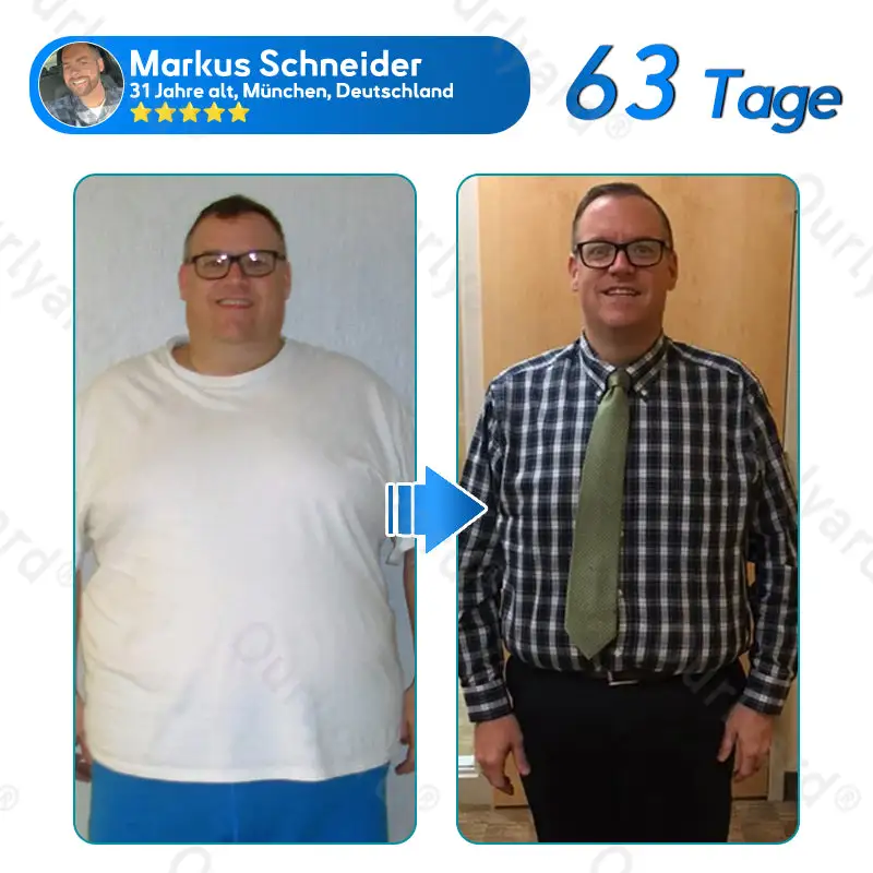 ๐๐๐ง๐จ๐ฉ๐๐ฅ๐๐ฌ๐ญ๐๐ซ - Image 7