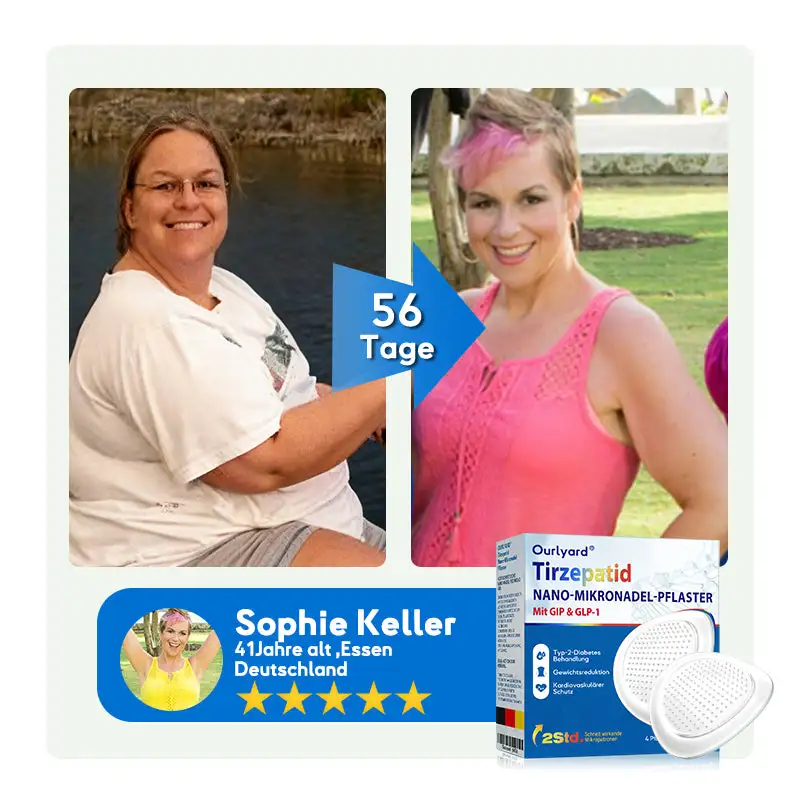 ๐๐๐ง๐จ๐ฉ๐๐ฅ๐๐ฌ๐ญ๐๐ซ - Image 8