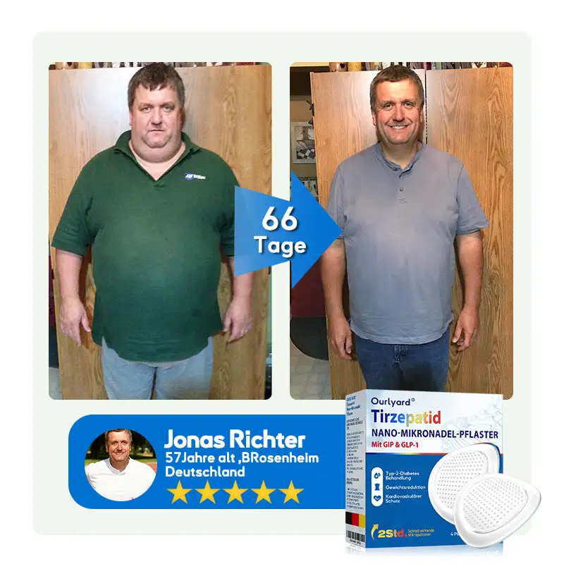 ๐๐๐ง๐จ๐ฉ๐๐ฅ๐๐ฌ๐ญ๐๐ซ - Image 9