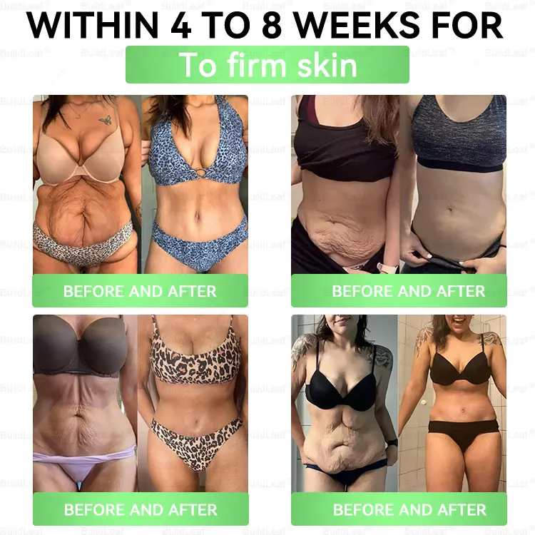 𝑮𝑳𝑷-1 8-𝒊𝒏-1 𝑶𝒓𝒂𝒍 𝑺𝒐𝒍𝒖𝒕𝒊𝒐𝒏 - Image 3