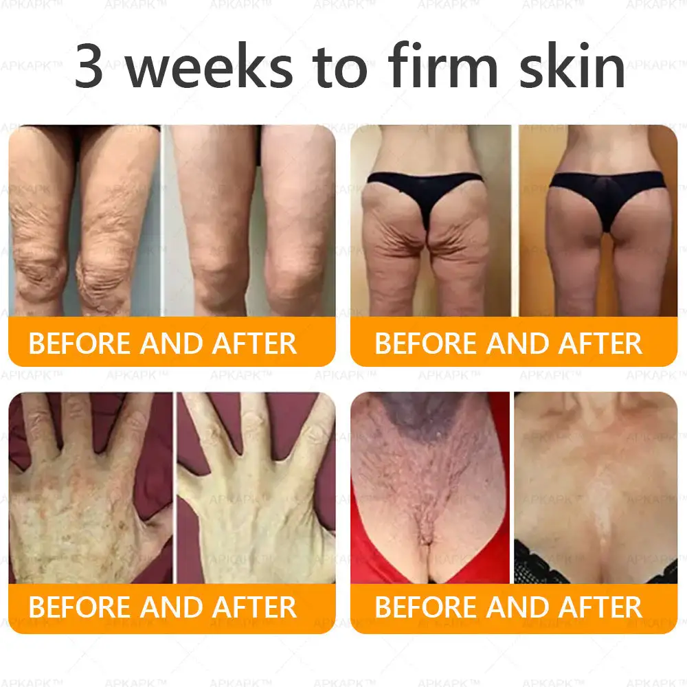 Bee Venom Comprehensive Cream - Image 4