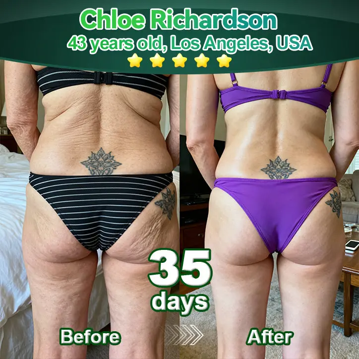 Luxurious Collagen & Stem Cell Anti-Cellulite Massage Oil - Image 4