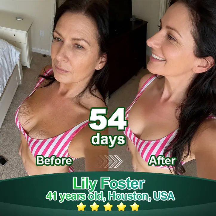 Luxurious Collagen & Stem Cell Anti-Cellulite Massage Oil - Image 6