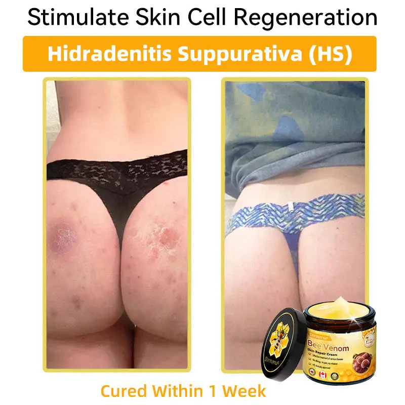 Bee Venom Repair Cream - Image 11