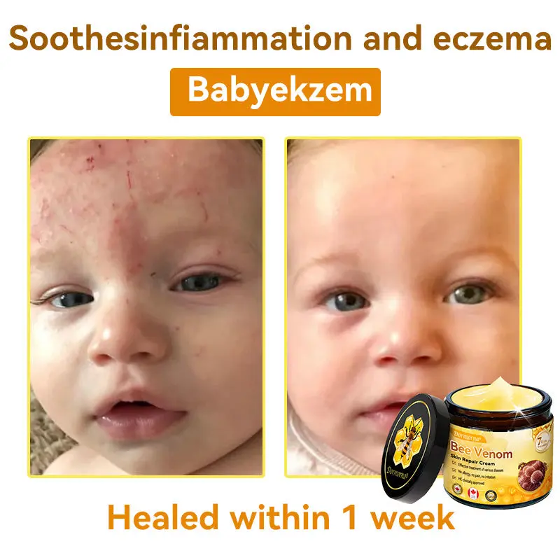 Bee Venom Repair Cream - Image 4