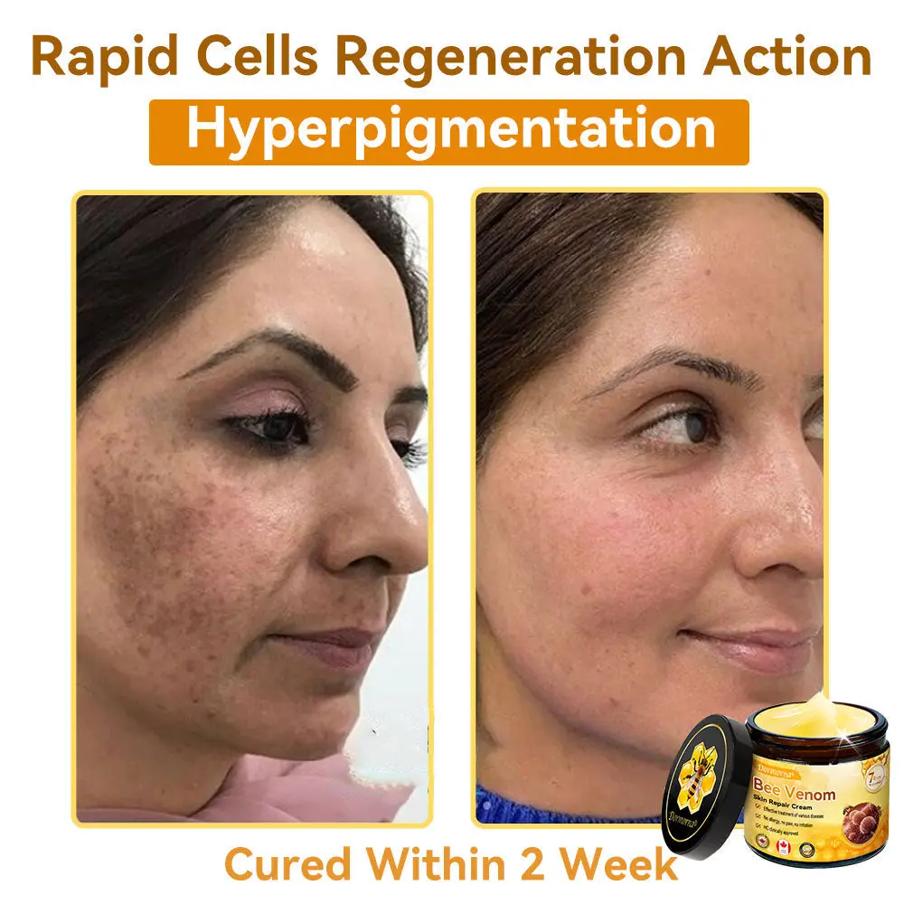 Bee Venom Repair Cream - Image 8