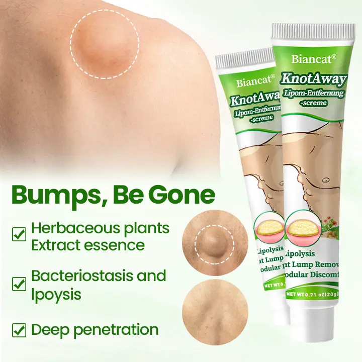 KnotAway Lipoma Removal Cream - Image 2
