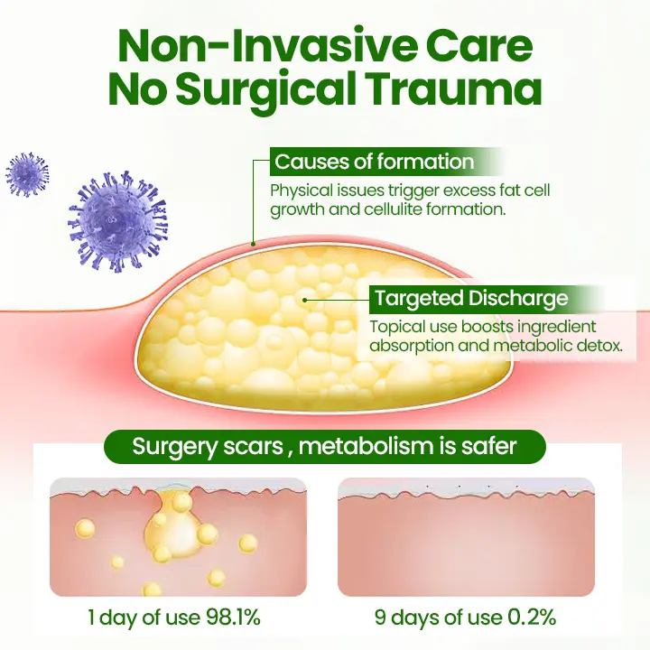 KnotAway Lipoma Removal Cream - Image 3
