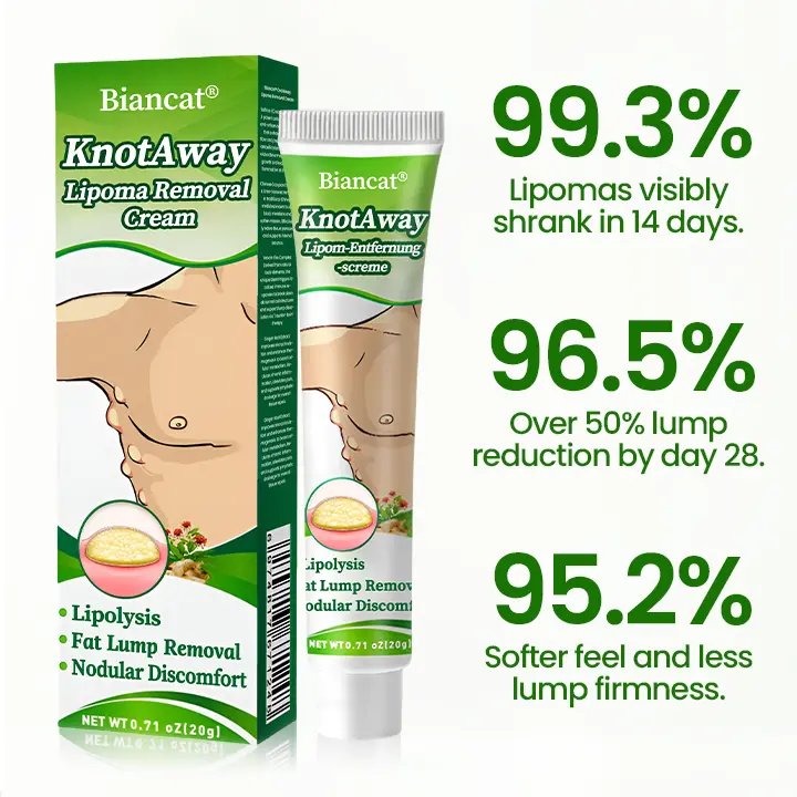 KnotAway Lipoma Removal Cream - Image 6