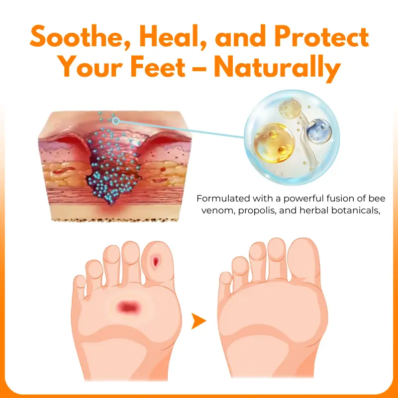 VenHeal Bee Venom Diabetic Wound Spray - Image 4