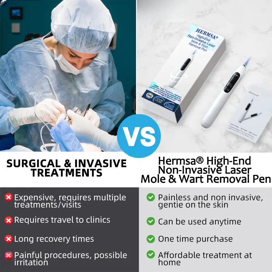High-End Non-Invasive Laser Mole & Wart Removal Pen - Image 11