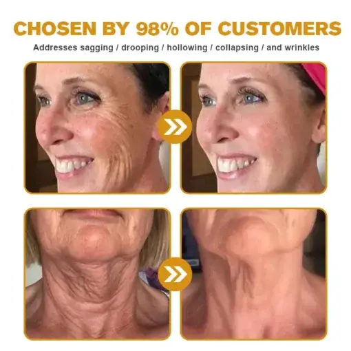 Instant skin tightening Cream - Image 3