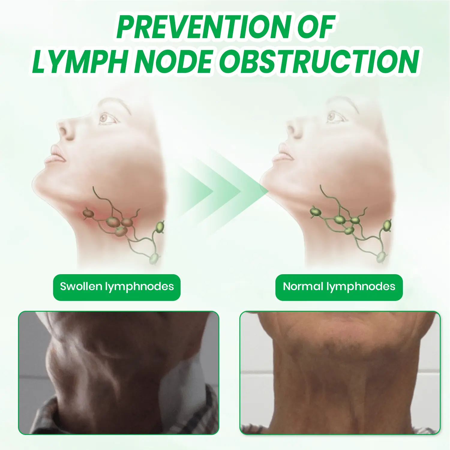 Lymphatic Detox Herbal Cream - Image 10