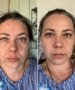 Mizurai® Nano Eye Drops Serum