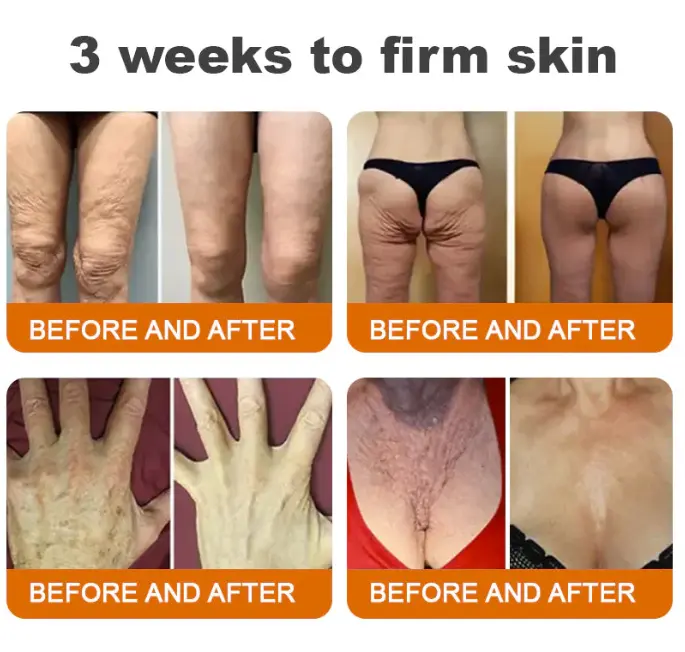 Bee venom Comprehensive Cream - Image 5