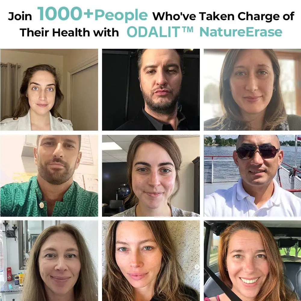 Nature Erase Instant Mole & Spot Removal Gel - Image 2