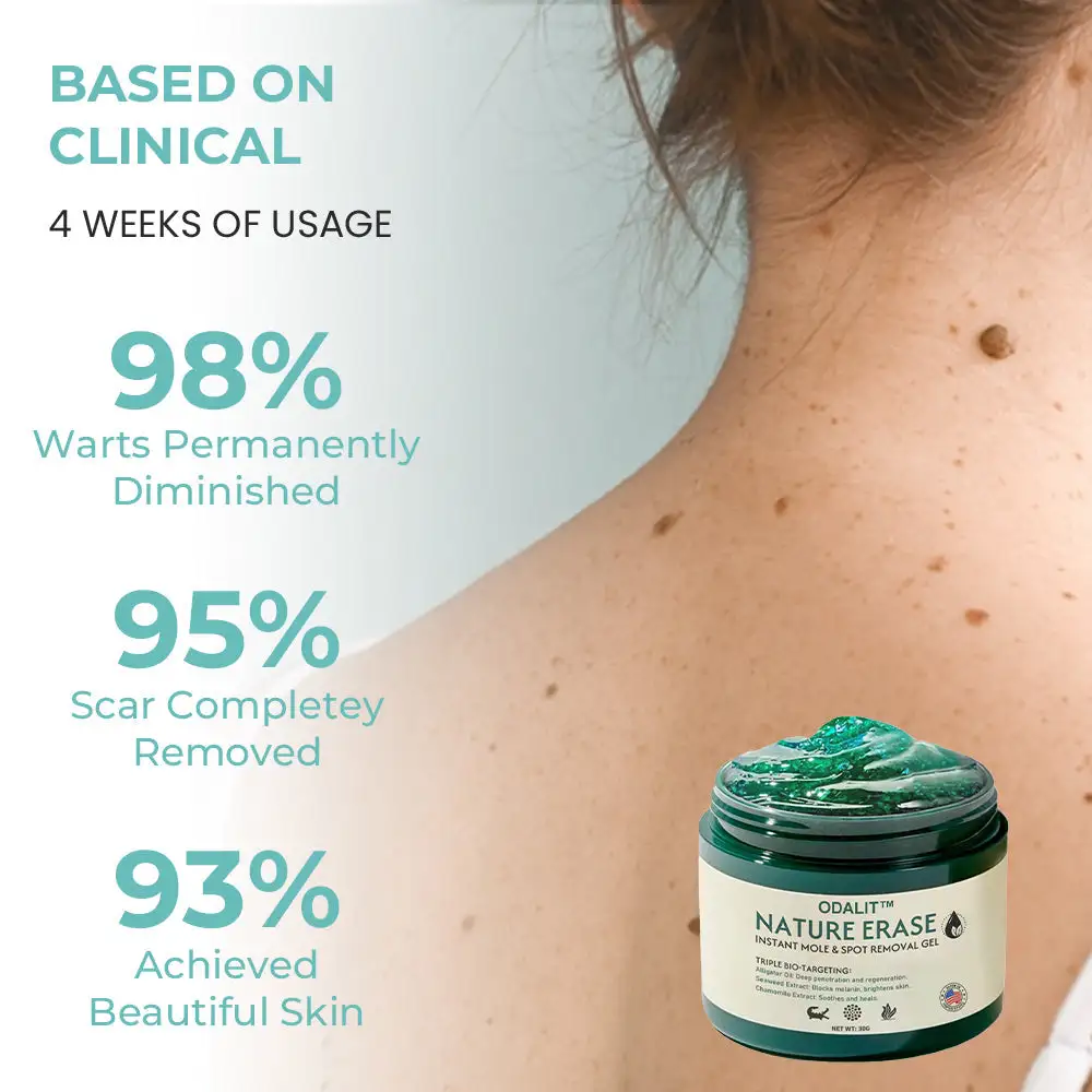 Nature Erase Instant Mole & Spot Removal Gel - Image 9