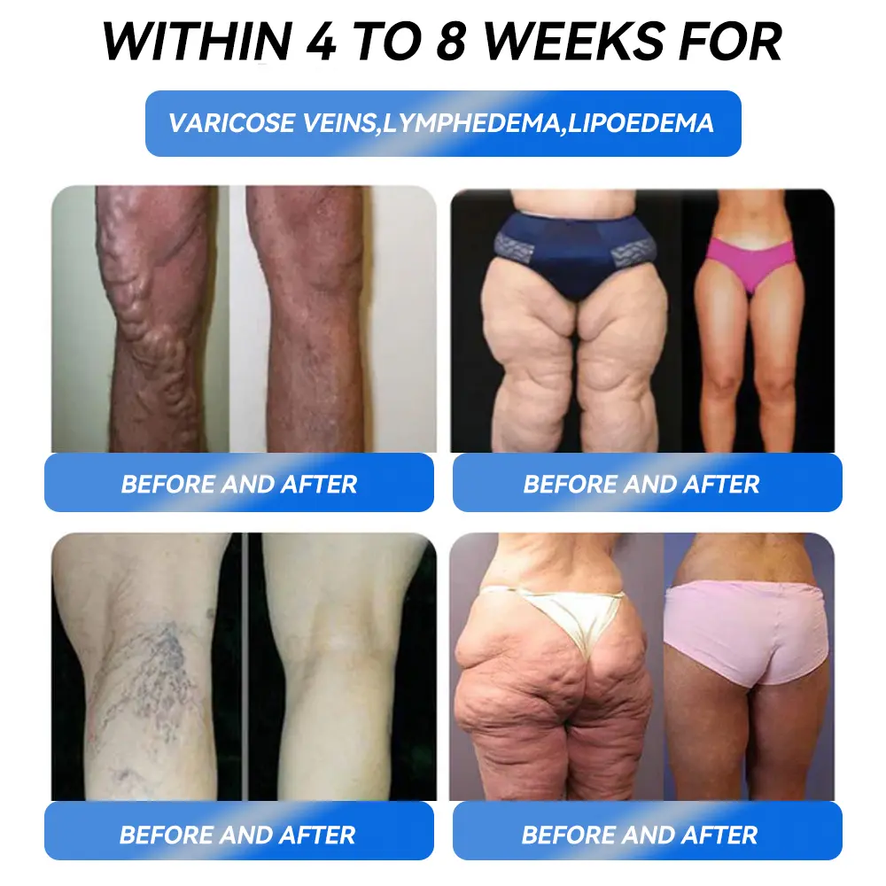 Weight Loss Oral Solution - Image 6