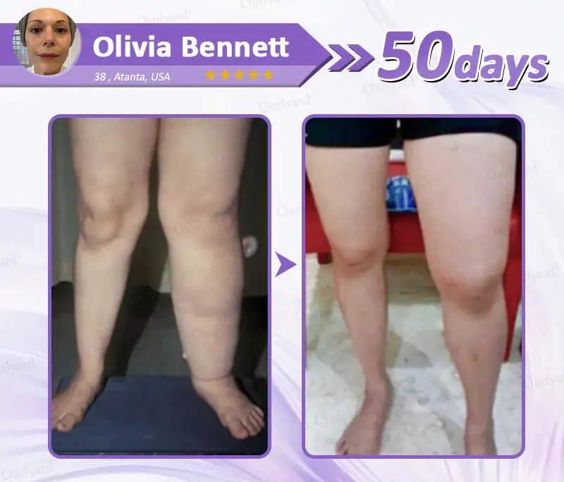 Slimming & Glucose-Control Ultra-Concentrated Wellness Essence Beads - Image 8