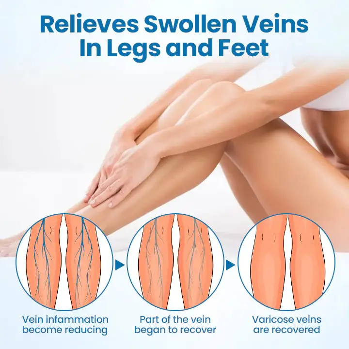 Herbal Leg Spray - Image 4