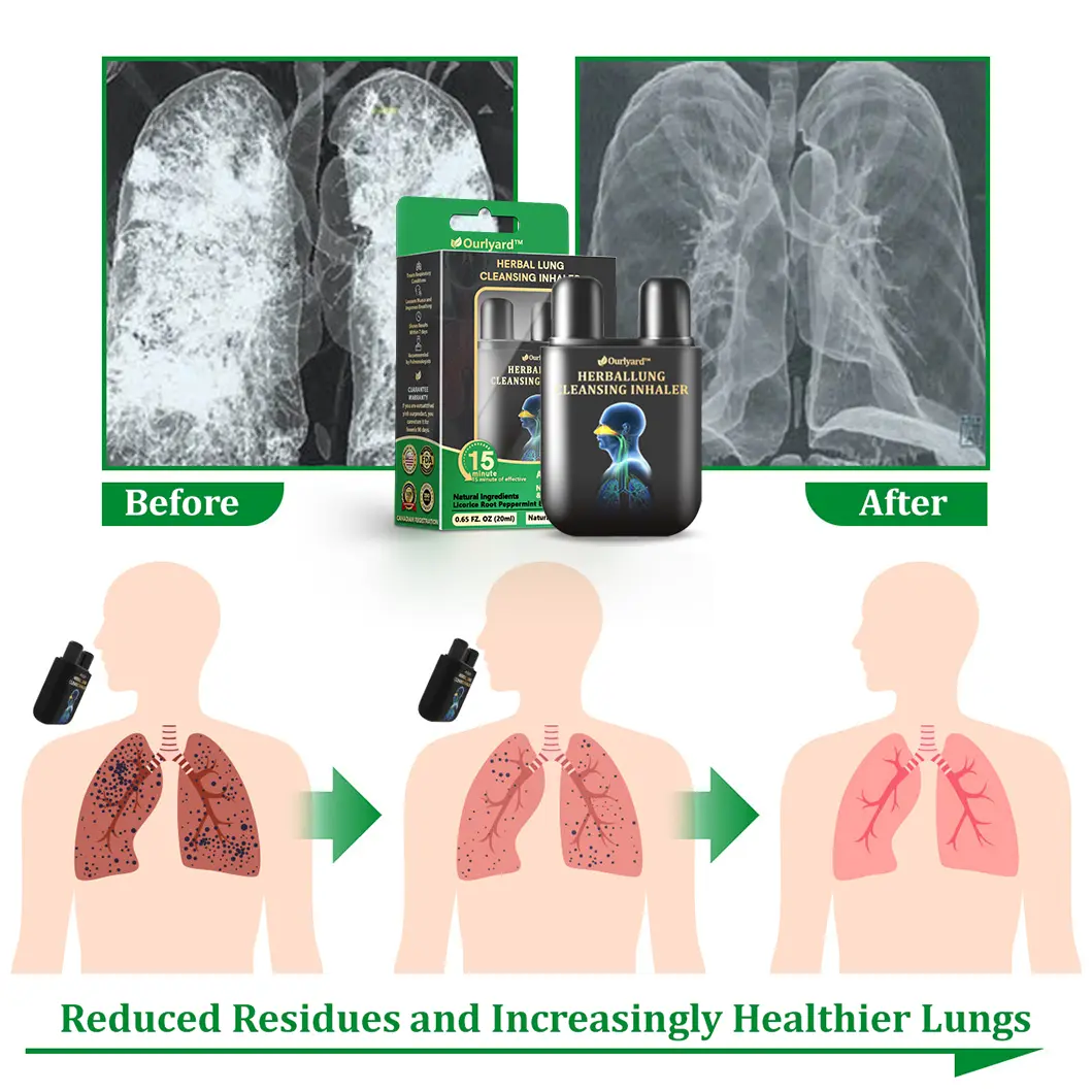 Herbal Lung Cleansing Inhaler - Image 7
