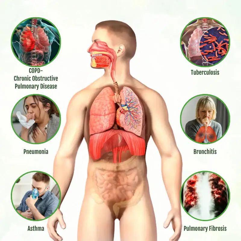 Lung Detox Relief Nasal Ring - Image 2
