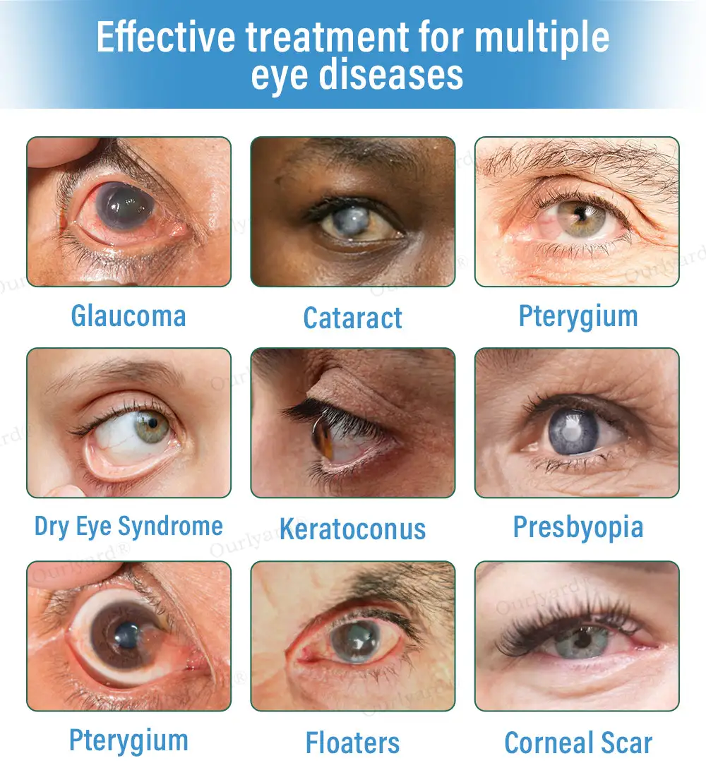 Supramolecular Eye Drops - Image 4