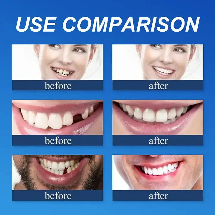 --Advanced Customized Full Denture Set - Image 8