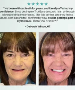 SEAGRIL™ Custom-Fit Full Functional Dentures