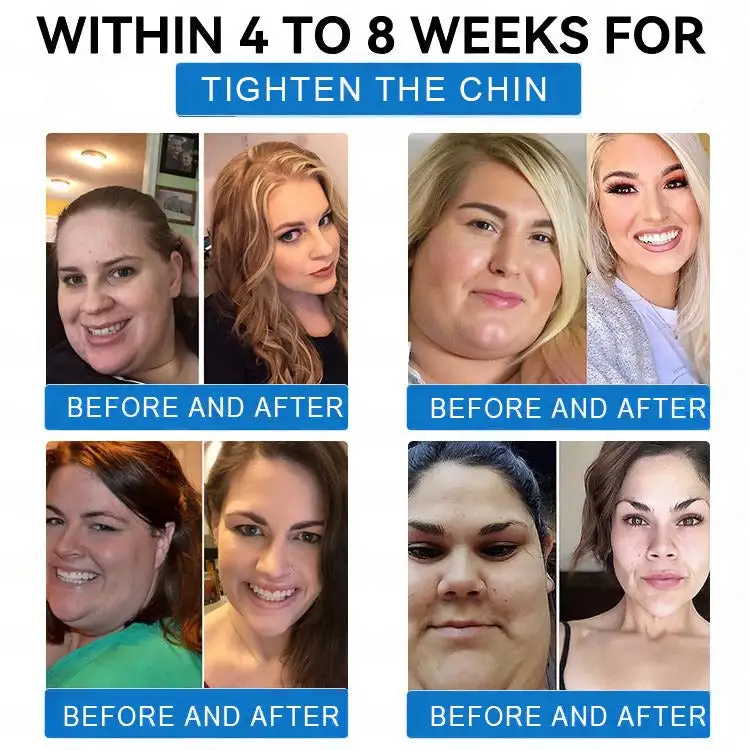 ๐๐จ๐ฅ๐ฅ๐๐ ๐๐ง ๐๐๐ง๐จ ๐๐ข๐๐ซ๐จ๐ง๐๐๐๐ฅ๐ ๐๐๐ข๐ ๐ก๐ญ ๐๐จ๐ฌ๐ฌ ๐๐๐ญ๐๐ก - Image 6