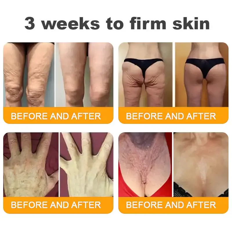 Bee Venom Skin Restoration Cream - Image 3