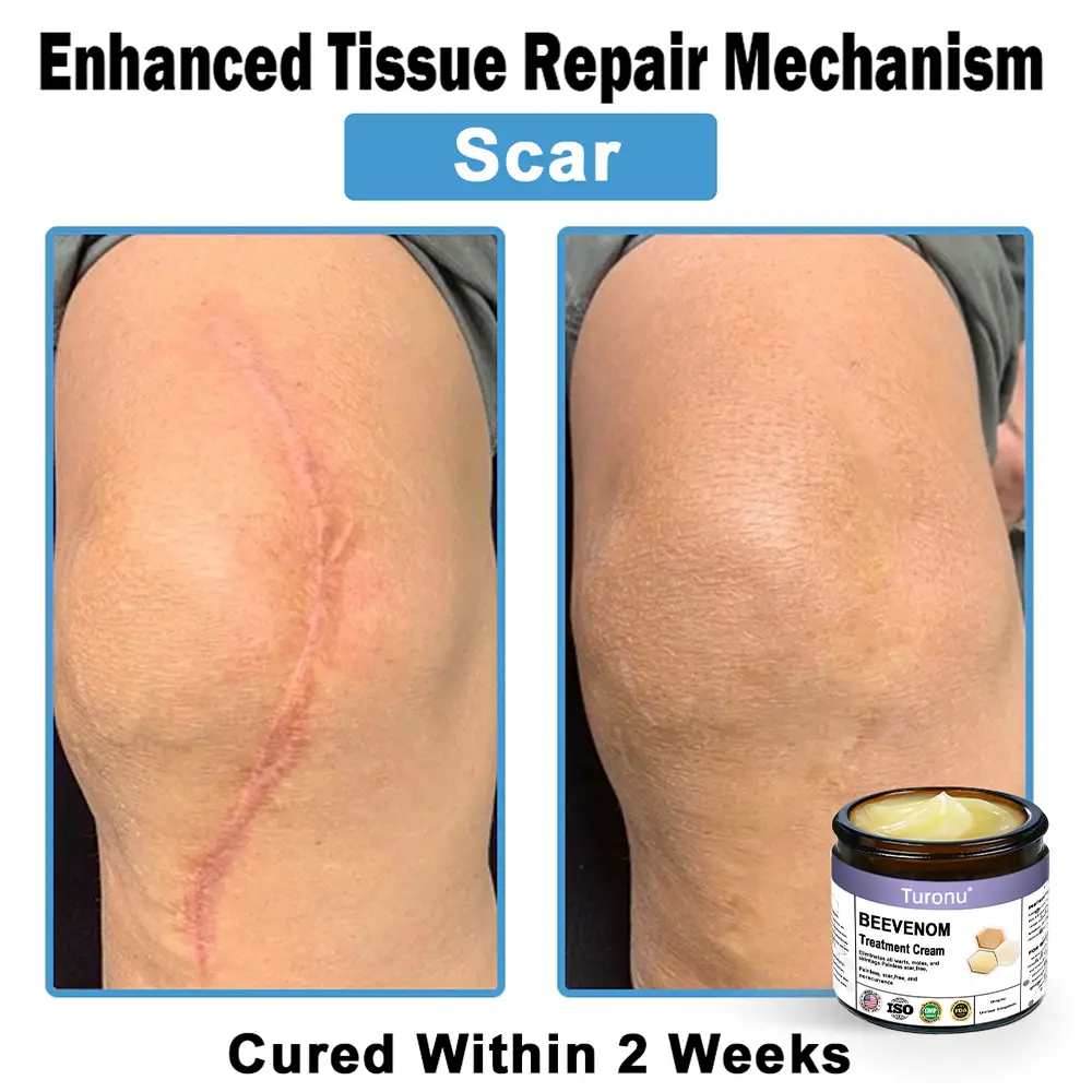 Bee Venom Skin Treatment Cream - Image 10