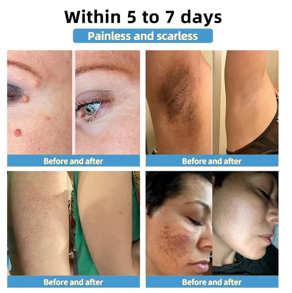 Bee Venom Skin Treatment Cream - Image 12