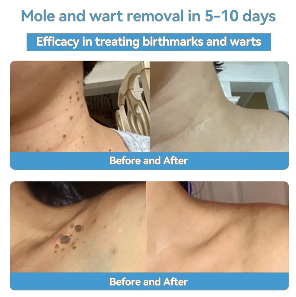 Bee Venom Skin Treatment Cream - Image 13