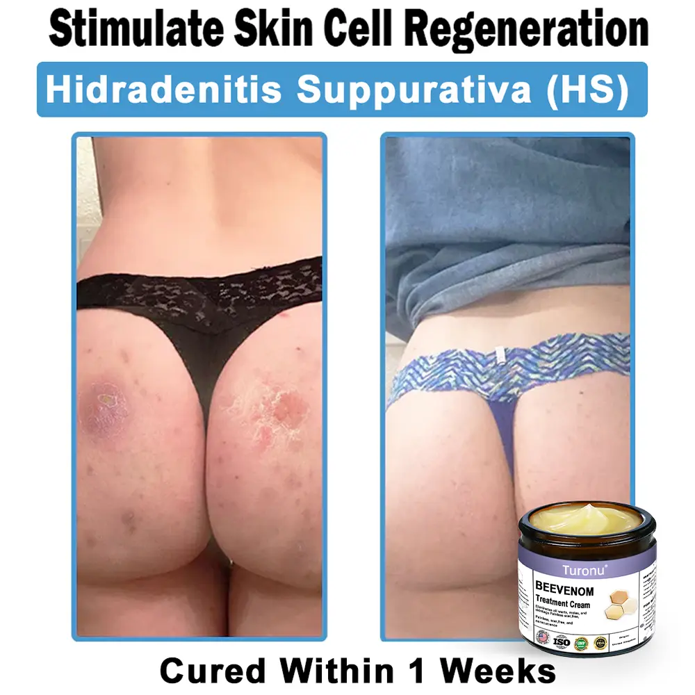 Bee Venom Skin Treatment Cream - Image 3