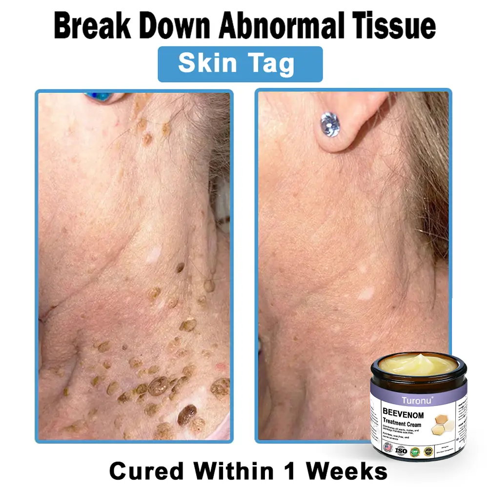 Bee Venom Skin Treatment Cream - Image 4