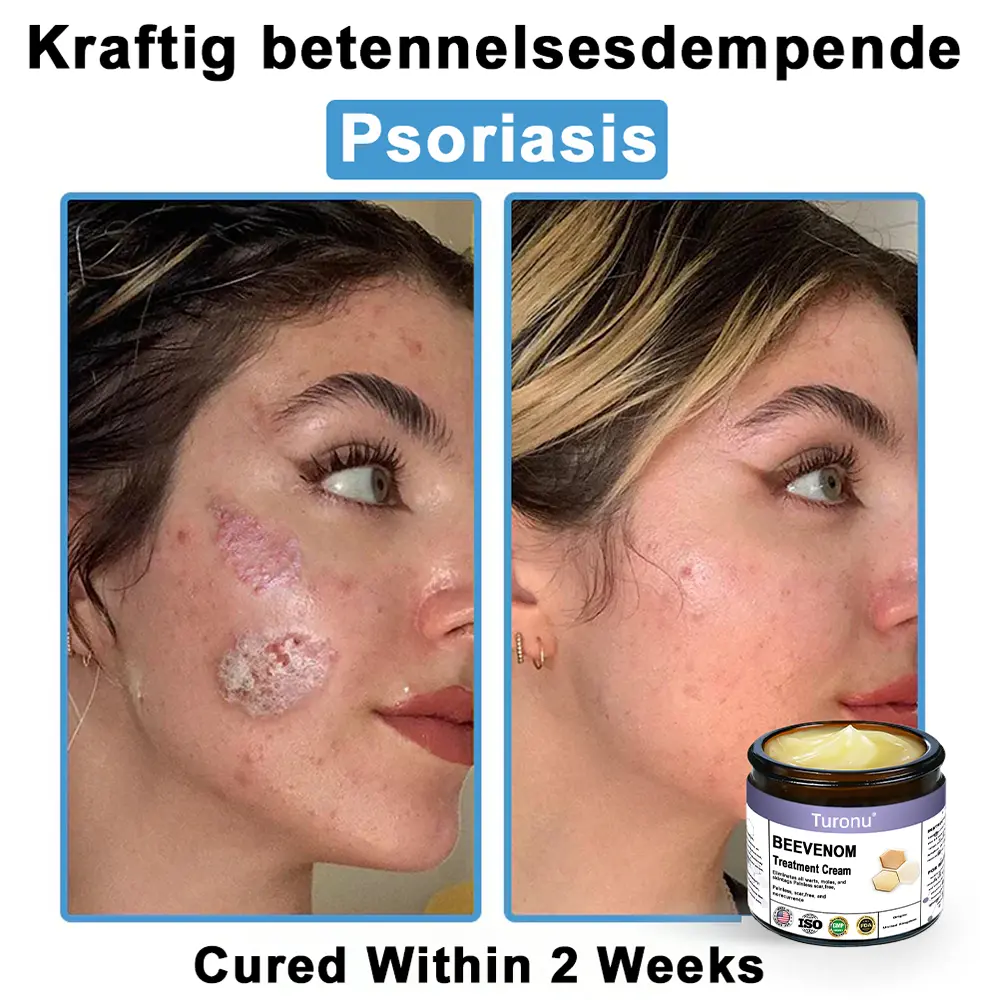 Bee Venom Skin Treatment Cream - Image 5