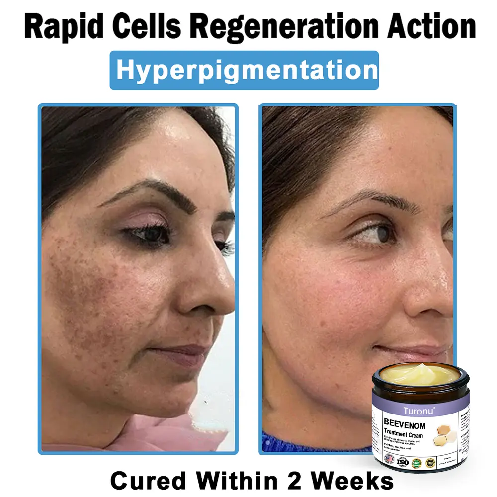 Bee Venom Skin Treatment Cream - Image 6