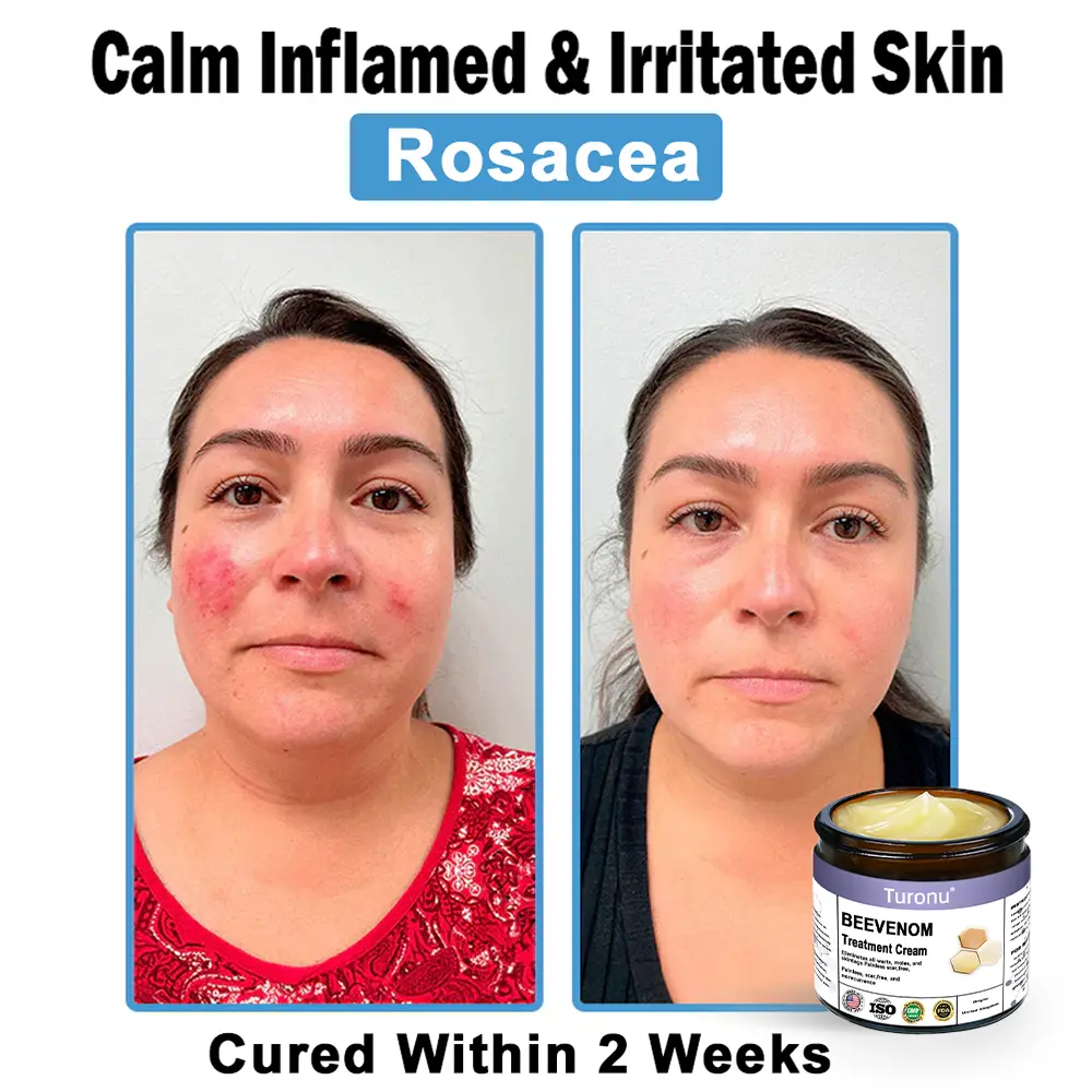 Bee Venom Skin Treatment Cream - Image 7