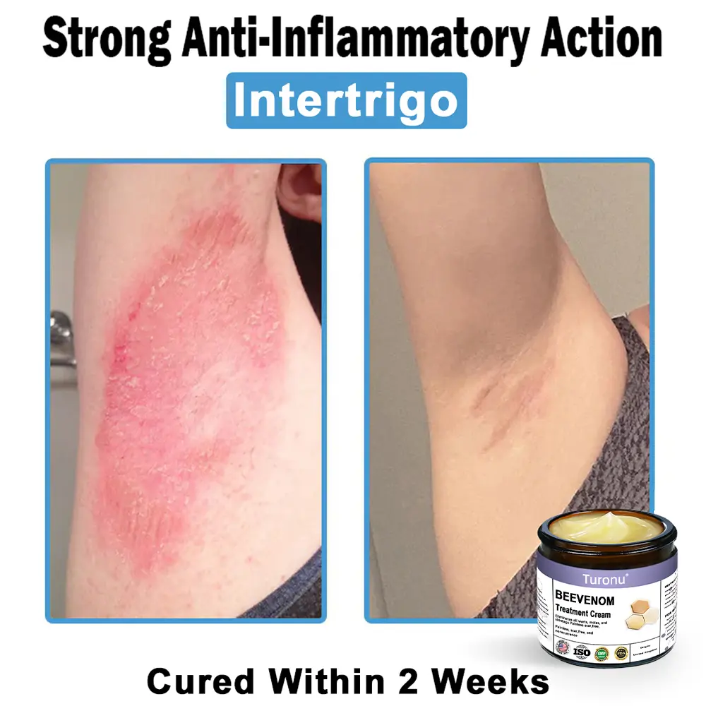 Bee Venom Skin Treatment Cream - Image 8