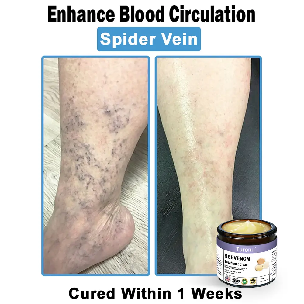 Bee Venom Skin Treatment Cream - Image 9