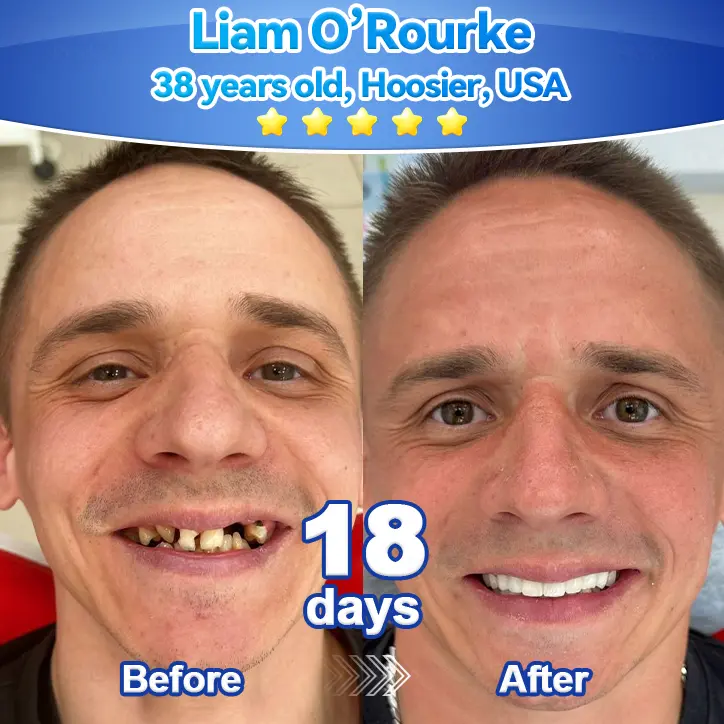 ๐๐๐๐๐ยฎ ๐๐ก๐๐ ๐ถ๐๐๐ ๐บ๐๐๐๐๐ฃ๐๐ ๐
๐๐๐๐๐ ๐๐๐ข๐ ๐ ๐