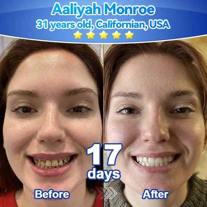 ๐๐๐๐๐ยฎ ๐๐ก๐๐ ๐ถ๐๐๐ ๐บ๐๐๐๐๐ฃ๐๐ ๐
๐๐๐๐๐ ๐๐๐ข๐ ๐ ๐