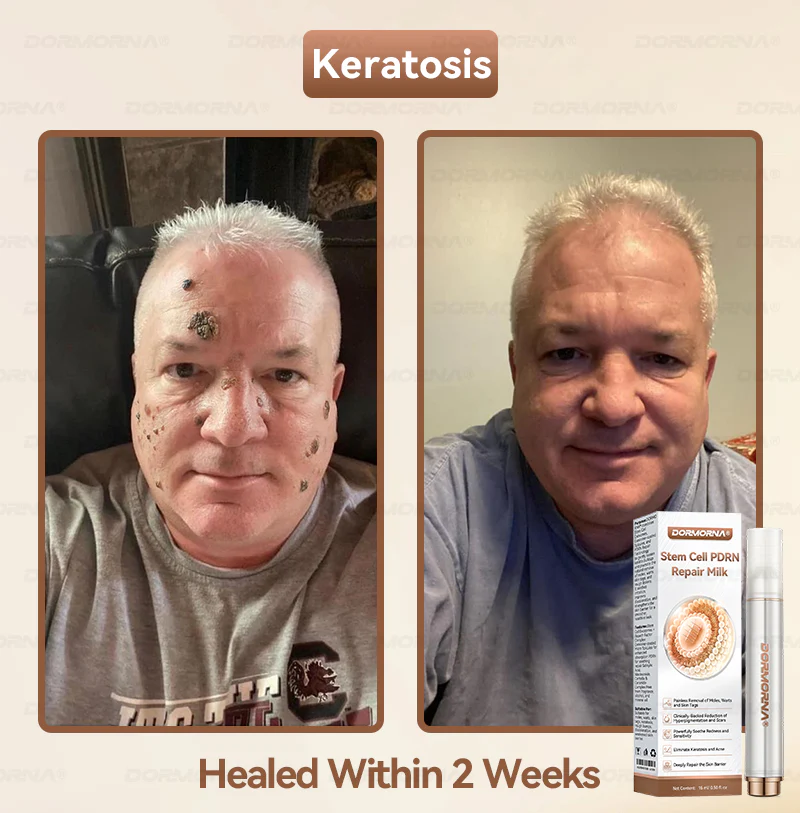 ๐๐ญ๐๐ฆ ๐๐๐ฅ๐ฅ ๐๐๐๐ ๐๐๐ฉ๐๐ข๐ซ ๐๐ข๐ฅ๐ค ๐๐๐๐๐๐๐ ๐๐ฑ๐จ๐ฌ๐จ๐ฆ๐-๐๐ง๐๐ฎ๐ฌ๐๐ ๐๐จ๐ซ ๐๐ค๐ข๐ง ๐๐๐ ๐๐ง๐๐ซ๐๐ญ๐ข๐จ๐ง & ๐๐ฆ๐ฉ๐๐ซ๐๐๐๐ญ๐ข๐จ๐ง ๐๐จ๐ซ๐ซ๐๐๐ญ๐ข๐จ๐ง - Image 3