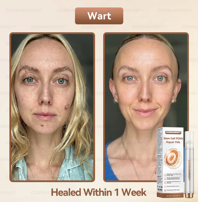 ๐๐ญ๐๐ฆ ๐๐๐ฅ๐ฅ ๐๐๐๐ ๐๐๐ฉ๐๐ข๐ซ ๐๐ข๐ฅ๐ค ๐๐๐๐๐๐๐ ๐๐ฑ๐จ๐ฌ๐จ๐ฆ๐-๐๐ง๐๐ฎ๐ฌ๐๐ ๐๐จ๐ซ ๐๐ค๐ข๐ง ๐๐๐ ๐๐ง๐๐ซ๐๐ญ๐ข๐จ๐ง & ๐๐ฆ๐ฉ๐๐ซ๐๐๐๐ญ๐ข๐จ๐ง ๐๐จ๐ซ๐ซ๐๐๐ญ๐ข๐จ๐ง - Image 2