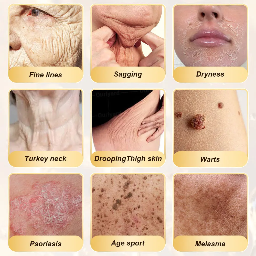 ๐ฉ๐๐ ๐ฝ๐๐๐๐ ๐บ๐๐๐ ๐น๐๐๐๐๐ & ๐จ๐๐๐-๐จ๐๐๐๐ ๐ช๐๐๐๐ - Image 2