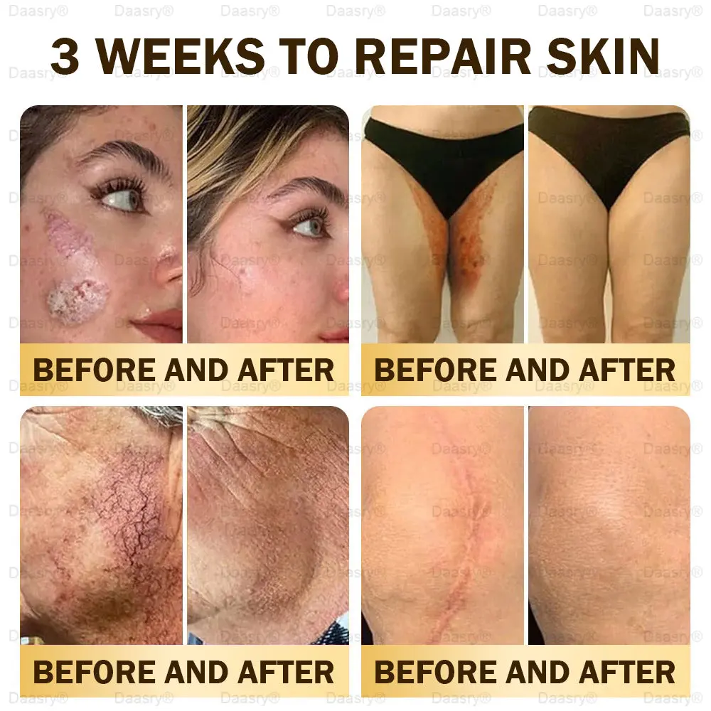 ๐ฉ๐๐ ๐ฝ๐๐๐๐ ๐บ๐๐๐ ๐น๐๐๐๐๐ & ๐จ๐๐๐-๐จ๐๐๐๐ ๐ช๐๐๐๐ - Image 4