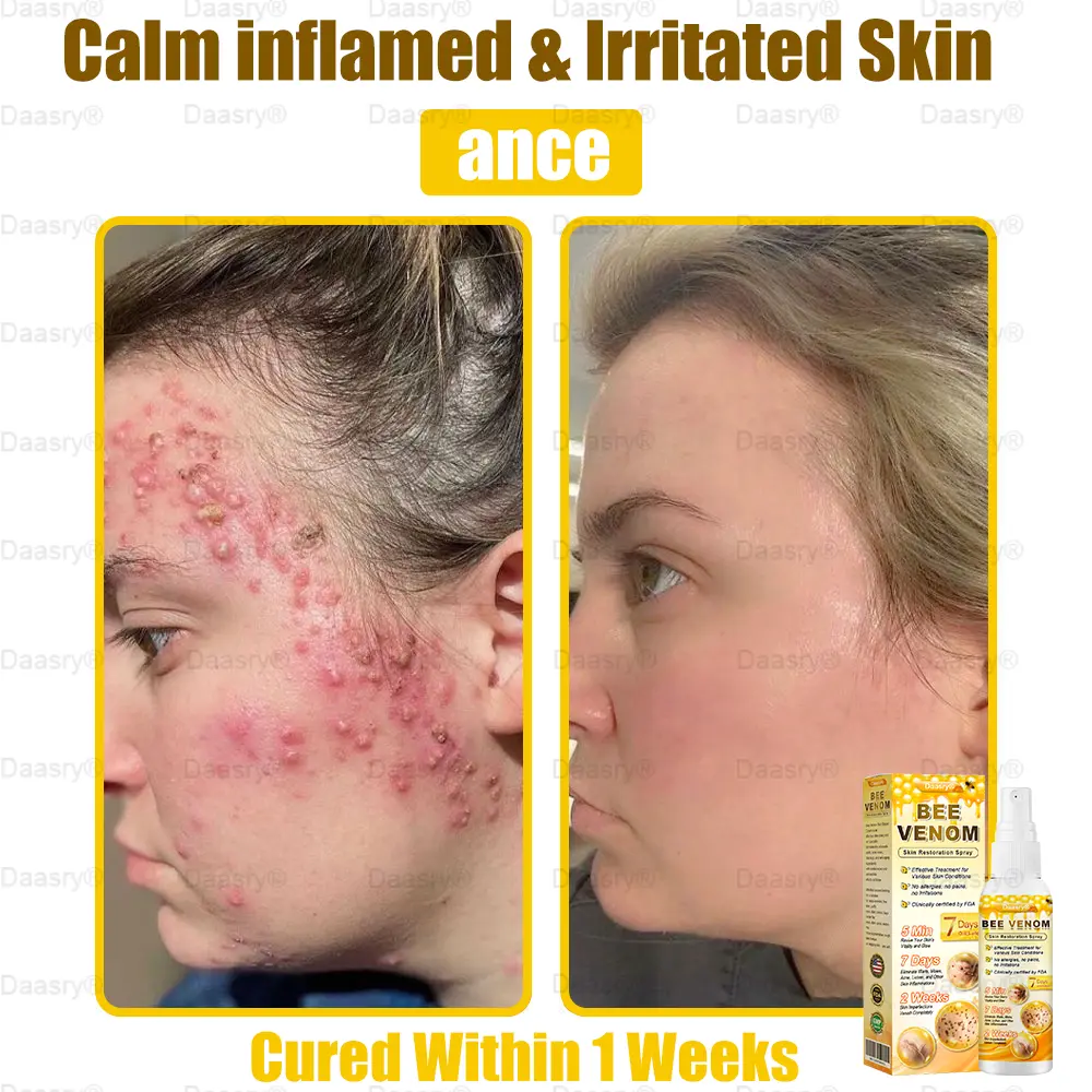Bee Venom Skin Restoration Spray - Image 10