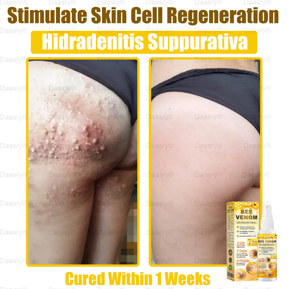 Bee Venom Skin Restoration Spray - Image 11