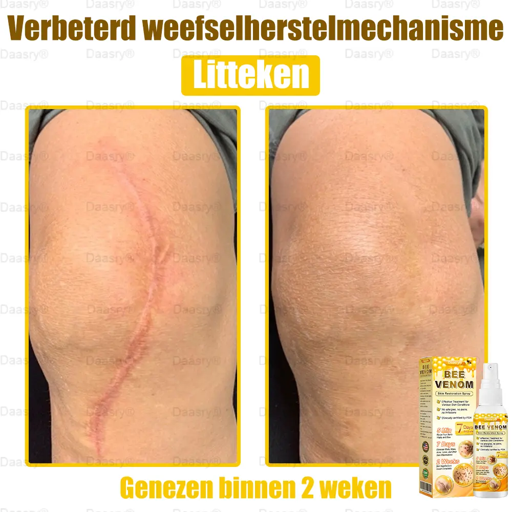 Bee Venom Skin Restoration Spray - Image 12